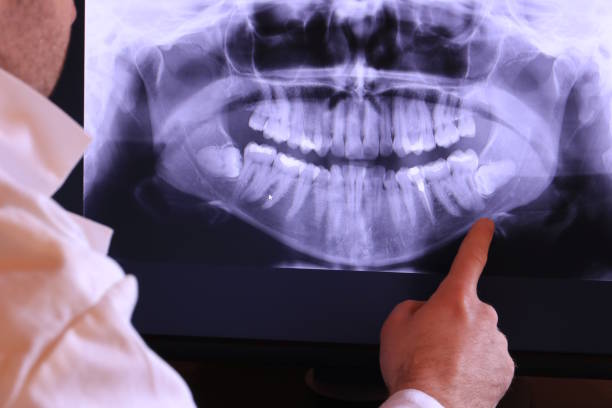 Best Weekend Emergency Dentist in Ridgefield Park, NJ